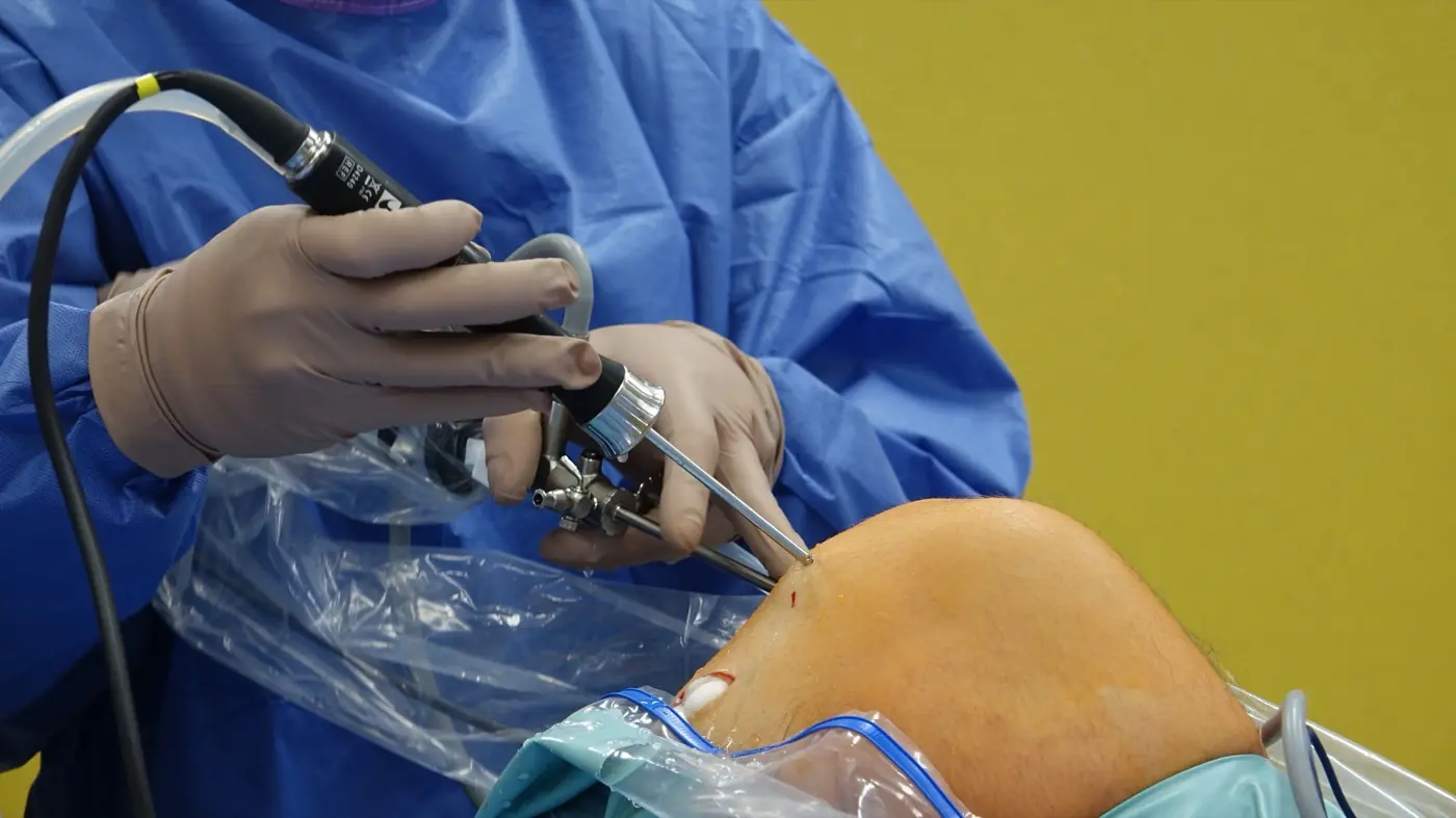 Cirugía artroscópica de rodilla: cuándo está indicada y cuándo no