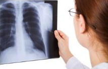 Recuperación del ligamento cruzado anterior: fases y plazos reales