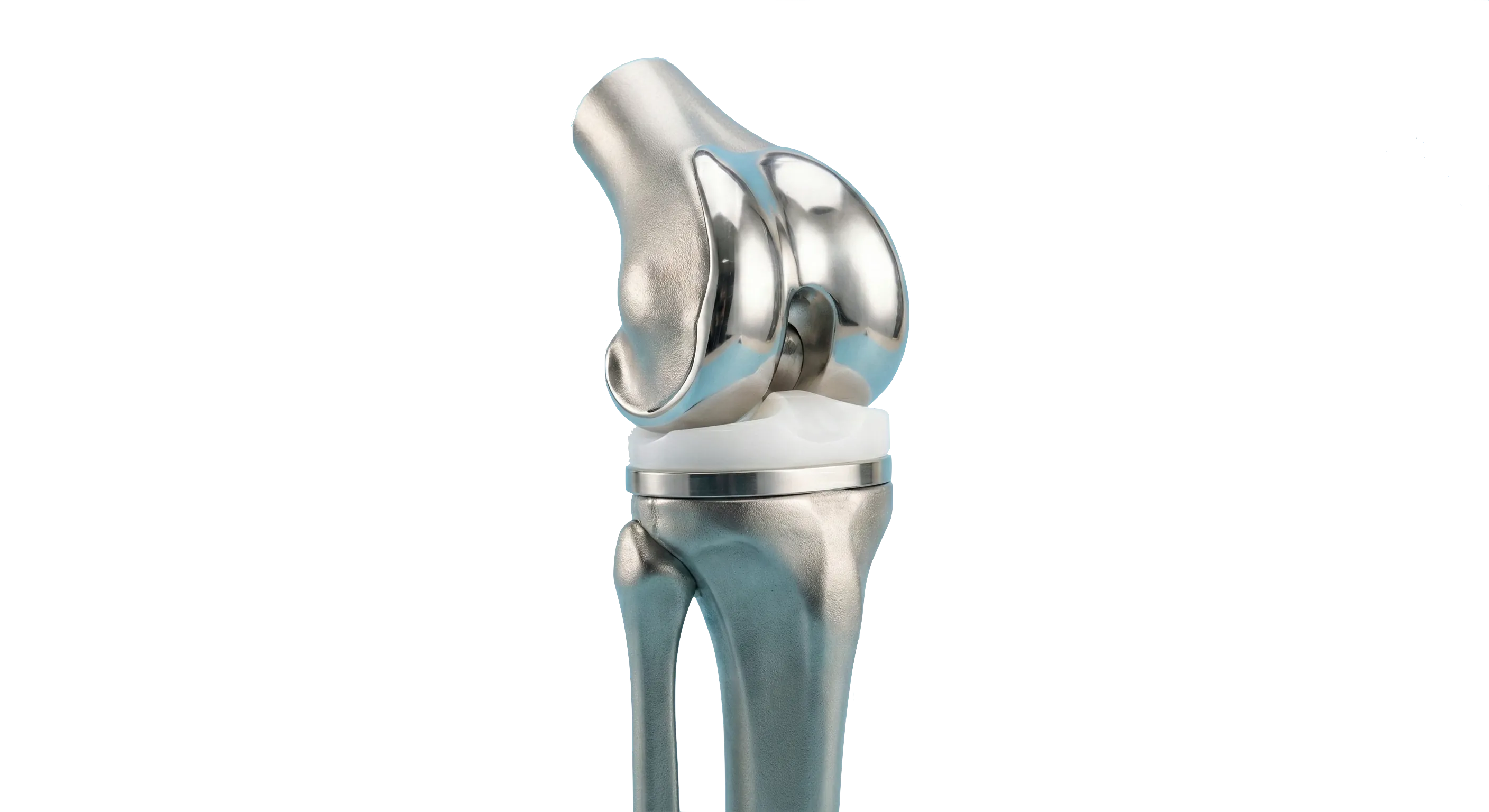 Protesis de rodilla